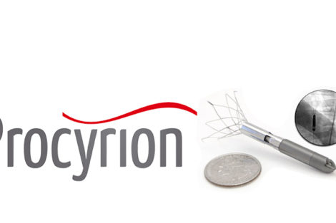 cardiorenal syndrome