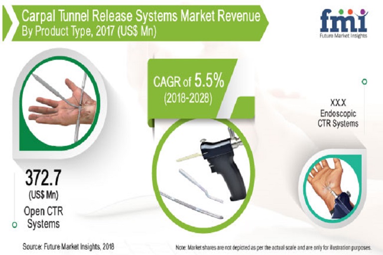 carpal tunnel release systems market