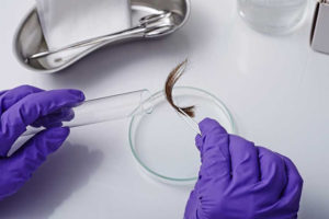 hair follicle drug test