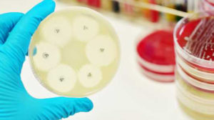 antimicrobial coatings market, global antibacterial coatings market, global opportunity analysis and industry forecast, market forecast