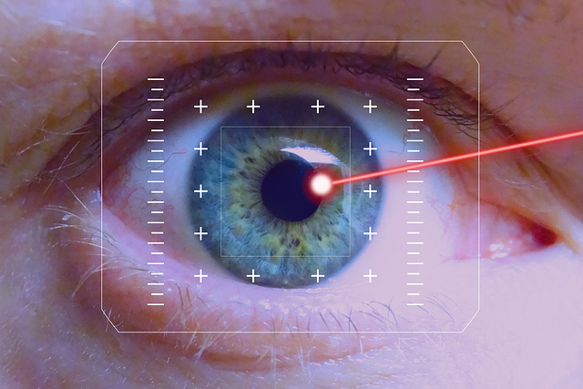 how long has laser eye surgery been around, history of refractive eye surgery, evolution of laser eye treatment, cost of laser eye surgery