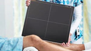 new carestream digital imaging, carestream’s dual energy imaging technology, radiological society of north america, working at carestream health