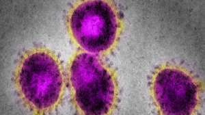 Roundup: Cyber-attacks, COVID-19 test results, care homes and more briefs