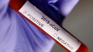 Dubai Health Authority bans rapid viral testing for COVID-19