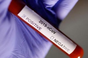 Dubai Health Authority bans rapid viral testing for COVID-19