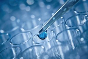 amyotrophic lateral scelrosis