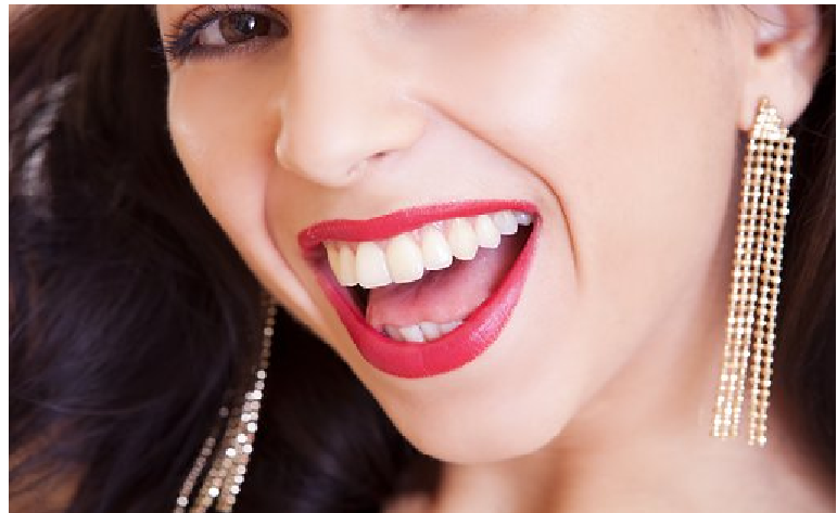 6 Reasons Why You Should Straighten Your Teeth