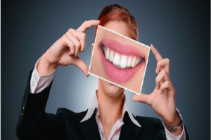 dental veneers