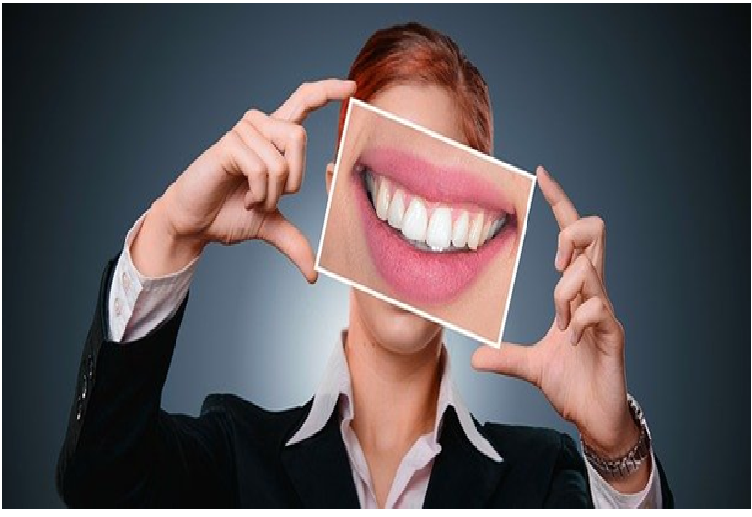 dental veneers