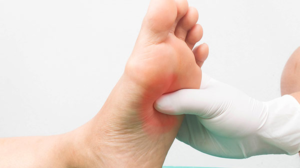 allergic diseases of skin