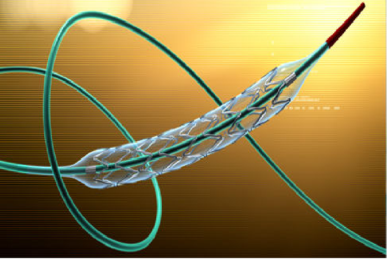 neurovascular disease