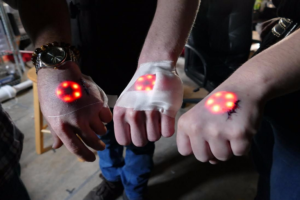 biohacking market size