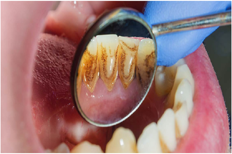 periodontal care