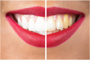 endodontist
