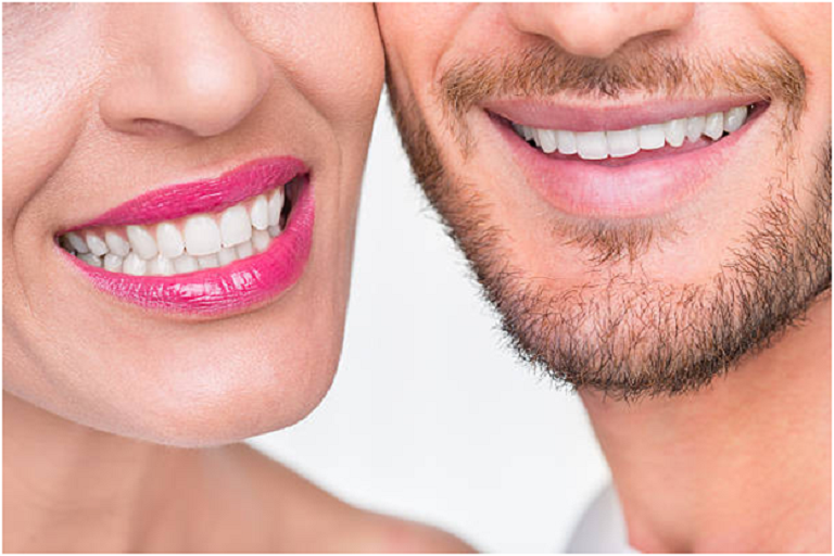 teeth whitening