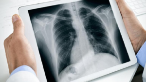 healthcare x-ray