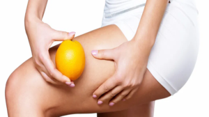 cellulite treatment market