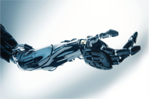 upper limb prosthetics