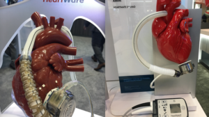 ventricular assist devices