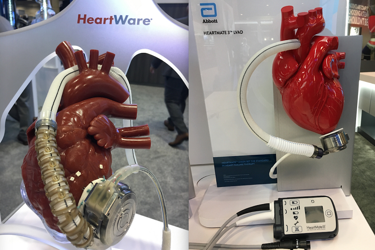 ventricular assist devices