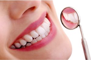 remove teeth stains