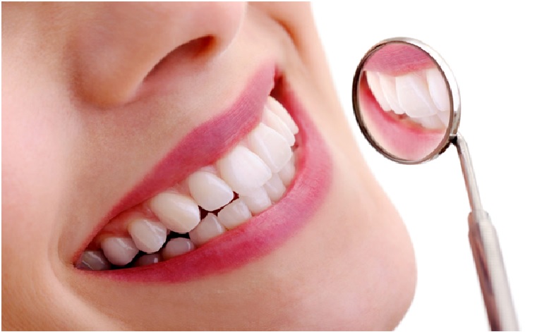 remove teeth stains