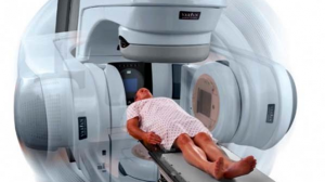 external beam radiation therapy