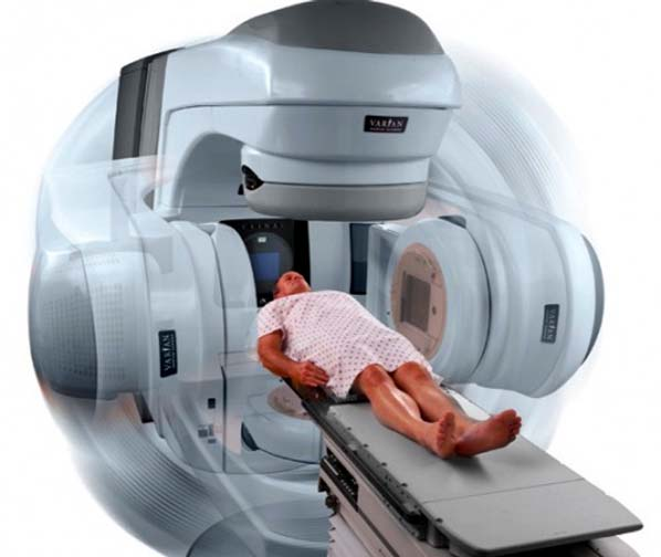 external beam radiation therapy