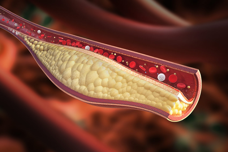 cholesterol types