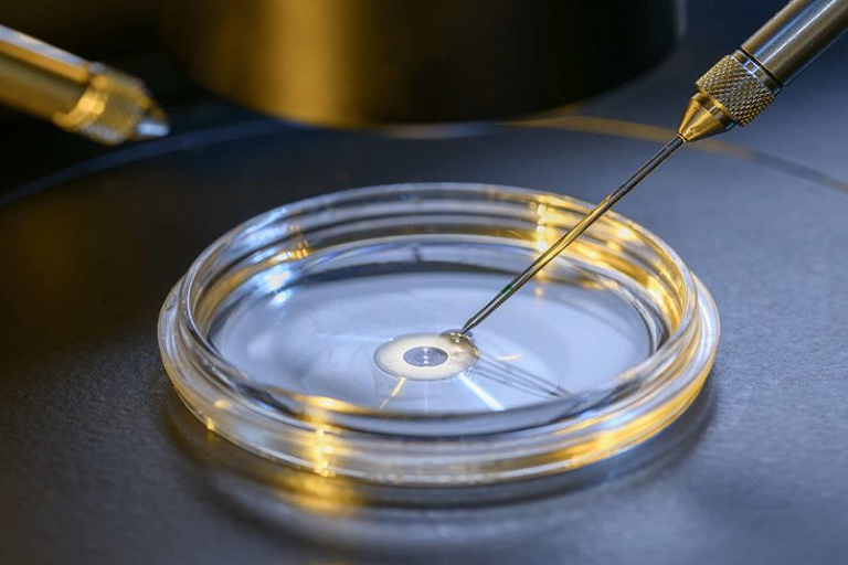 in vitro fertilization