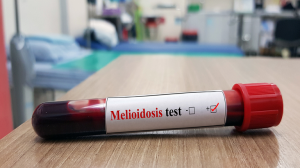 melioidosis