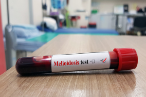 melioidosis