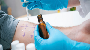 allergy diagnostics