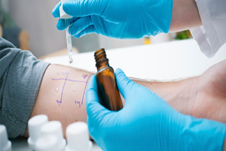 allergy diagnostics