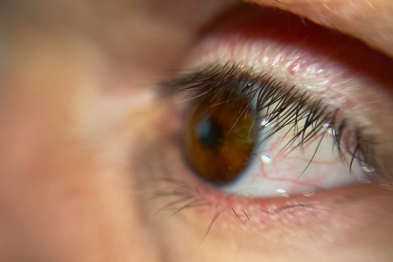 fraunhofer technology